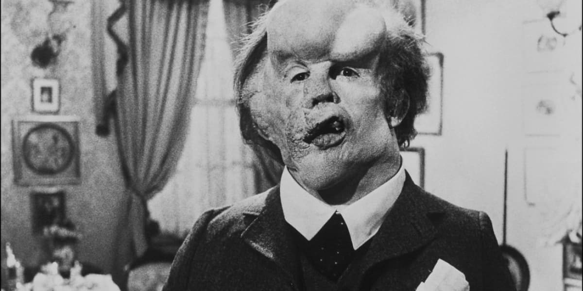 Người Voi (The Elephant Man)